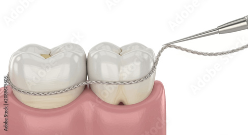 3D Render of Dental Flossing Procedure Showing Proper Teeth Cleaning Technique Between Molars for Oral Hygiene Maintenance