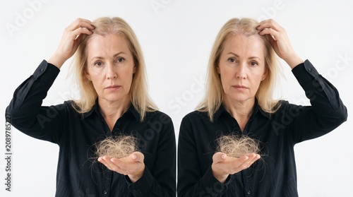 A worried mature blonde woman wearing a black shirt holds a clump of fallen hair while looking into the camera with a concerned expression against a clean white studio backdrop.