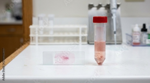 Fine needle aspirate specimen slide and a RPMI transport tube on a cytopathology research bench.