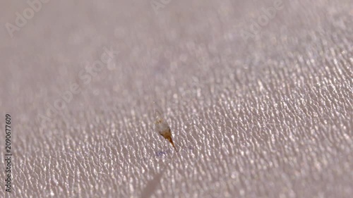 Honey Bee Stinging Human Skin with Visible Stinger Close Up Macro
