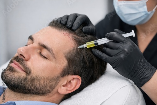 Hair restoration injection procedure on patient head. Ai generative