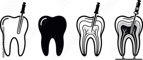Valokuva A series of four black and white vector illustrations showing the progressive st