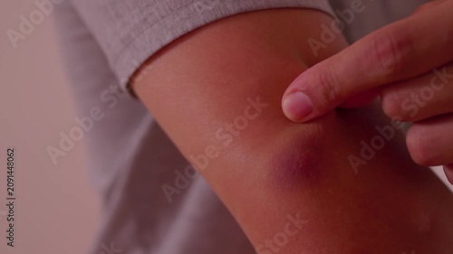 neutral healthcare professional points at small mark on patient's arm in close-up examination setting with white shirt and neutral wall background, commercial medical examination visual.