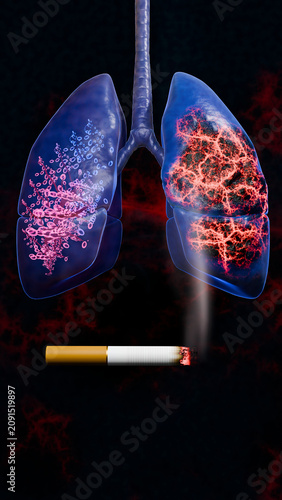Smoking effects on the lungs visualized in a 3D model, showing severe lung disease, tar deposits, cancerous growths, emphysema, and irreversible respiratory system damage due to prolonged cigarette 