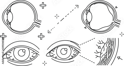 Photos Ophthalmology Eye Disease Line Icon Set Featuring Eyeball Anatomy Retinal Detach
