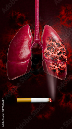 Smoking effects on the lungs visualized in a 3D model, showing severe lung disease, tar deposits, cancerous growths, emphysema, and irreversible respiratory system damage due to prolonged cigarette