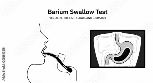 Bild auf Leinwand Medical infographic illustrating a Barium Swallow Test procedure, showing a patient drinking contrast medium and a resulting X-ray visualization of the esophagus and stomach on a monitor