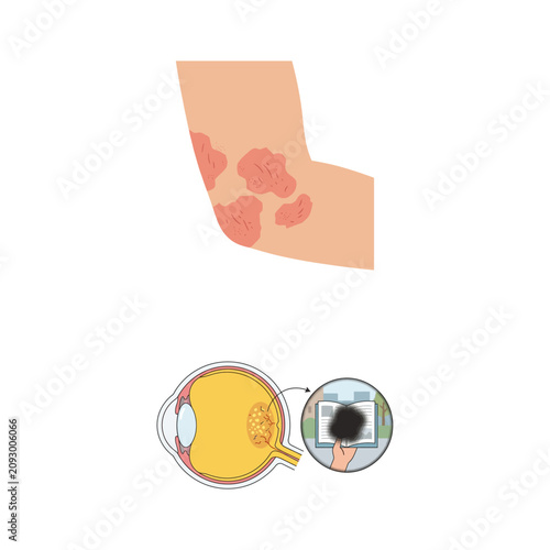 Konstfotografi Medical Illustration of Skin Eczema and Macular Degeneration Vision Impairment