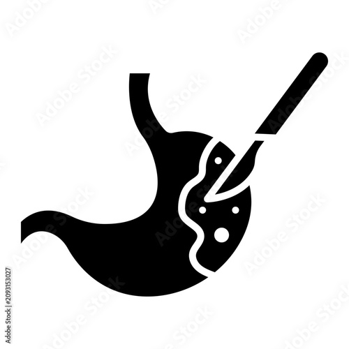 фотографія Stomach Cancer Surgery with Scalpel Procedure