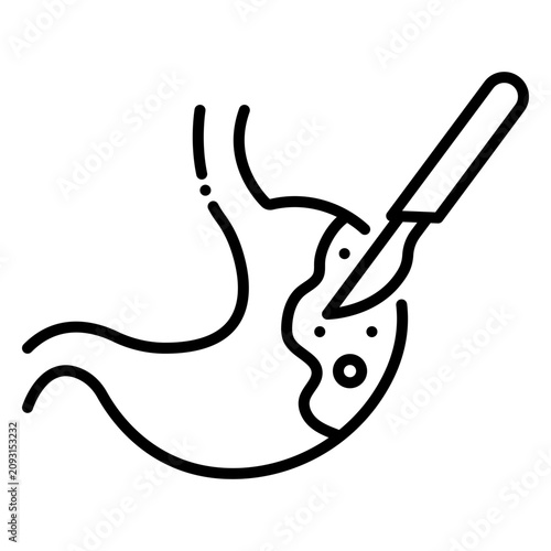 Tableau sur toile Stomach Cancer Surgery with Scalpel Procedure