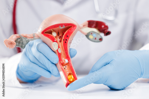 Foto Doctor pointing at uterus model highlighting vitamins and suppositories to resto