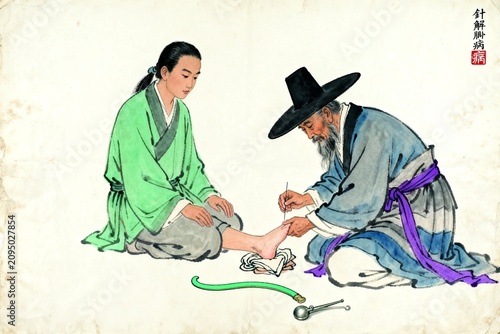 Traditional Chinese acupuncture treatment for foot pain