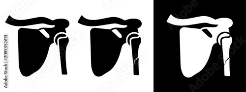 Cuadro en lienzo Shoulder broken bone icon silhouette, Clipart vector illustration