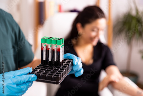 Close-up of a doctor holding a rack of blood sample test tubes after venipuncture with a female patient blurred in the background.