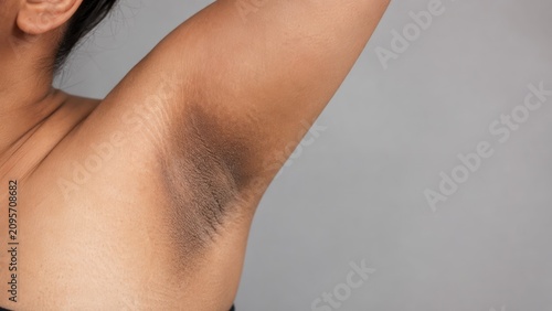 Close-up of underarm skin with natural dark pigmentation on light brown skin tone