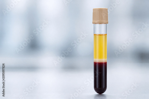 Separated Blood Sample Tube In Clean Laboratory Macro