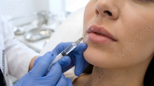 Lip filler injection on woman. Cosmetic procedure for facial enhancement.
