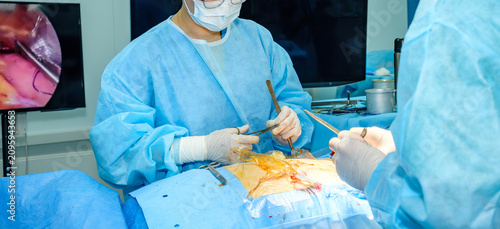 Assistant surgeon holding medical tools while looking at endoscopic monitor screens during operation.