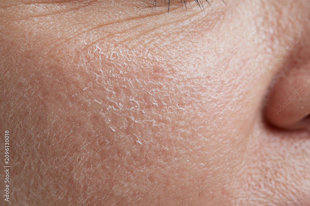 Fototapeta premium Dry facial skin close up showing slight flaky texture and fine facial hair with visible pores and wrinkle lines conveying natural aged skin detail