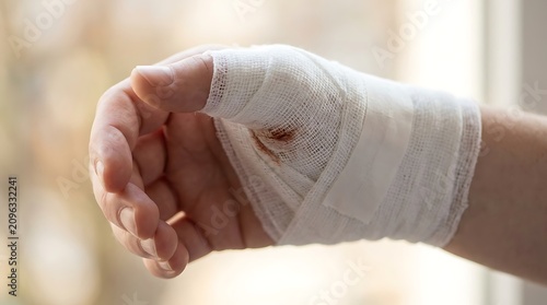 Close up of human hand with bandaged thumb showing stains after injury medical first aid concept with white gauze wrap on injured finger