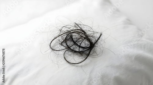 Strands of fallen dark hair on a white pillow, symbolizing alopecia or shedding