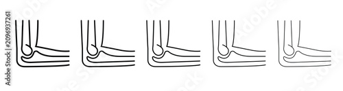 Foto Anatomy of human elbow joint icons set, clean line weight variations, medical outline design