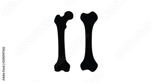 Two human femur bones depicted as a stark black silhouette against a white background