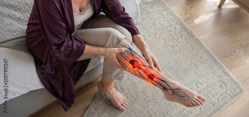 Woman suffering from varicose veins on sofa indoors, closeup.