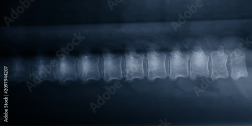 Photos An X-ray image clearly displays a segmented spinal column, showcasing the intricate bone structure and intervertebral spaces in a medical diagnostic view