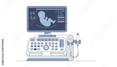 Modern ultrasound machine displaying fetal scan