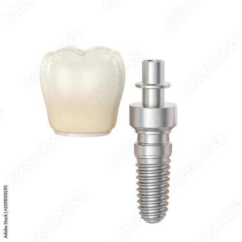 Canvastavla Dental crown and implant abutment for tooth restoration