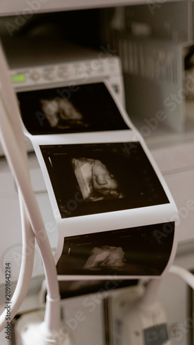 Photography Printed ultrasound sonogram photos emerging from diagnostic machine in obstetric