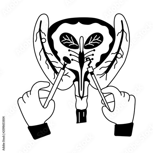 Fotografie A doodle style illustration showing bladder surgery