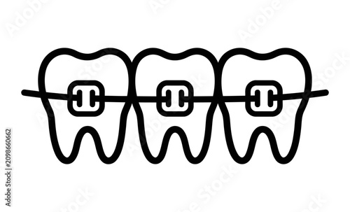 Dental Braces on Teeth Vector Illustration
