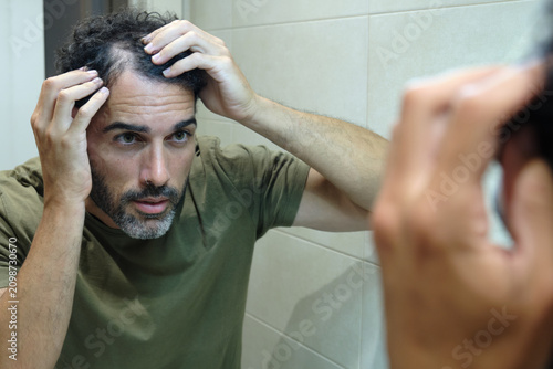 Man examining receding hairline and bald spot, expressing concern about hair regrowth