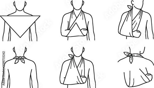 Tableau sur toile Step-by-step guide on applying a triangular bandage as an arm sling a medical fi