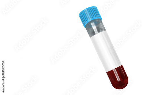 фотографія Light blue cap sodium citrate blood collection tube isolated on transparent background