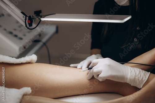 Aesthetician performing electrolysis hair removal treatment on leg
