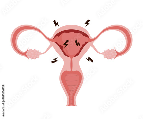 Female uterus with pain lightning bolts showing menstruation period