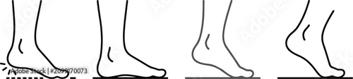 Photos Medical Vector Icon Set of Human Foot Anatomy Showing Flat Foot Conditions, Norm