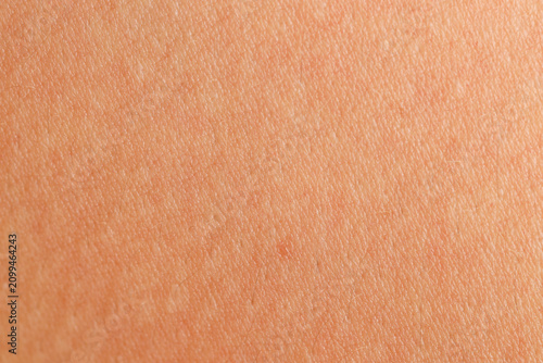 Fotografie Texture of normal skin as background, closeup