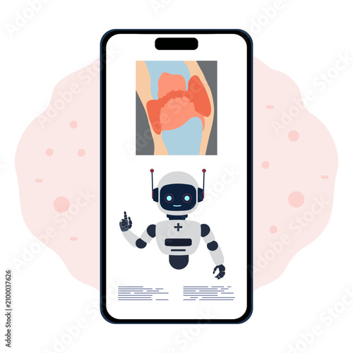 Medical AI robot on smartphone screen with anatomical knee illustration in background