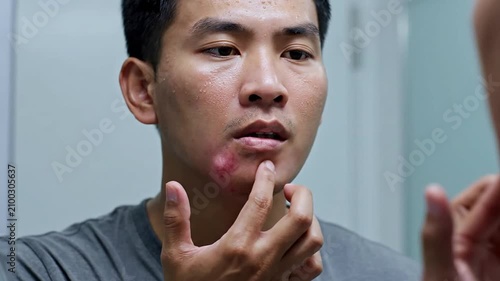 Man Examining Skin Blemish On His Face While Looking In The Mirror In A Clean Bathroom Environment