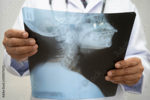 Принти на полотні Doctor examining cervical vertebrae bone radiography xray film.