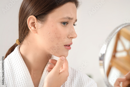 Young woman with acne probl...
