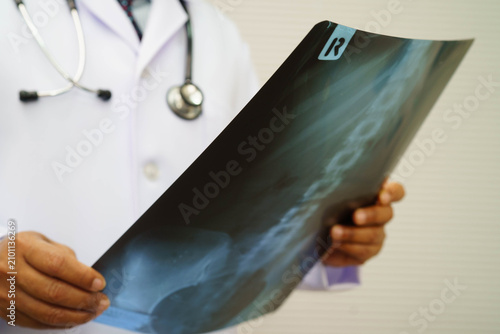 Obraz na plátně Doctor examining spine bone radiography xray film.