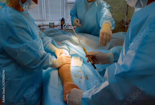 Photography cosmetic liposuction surgery in actual operating room setting showing surgeon ha