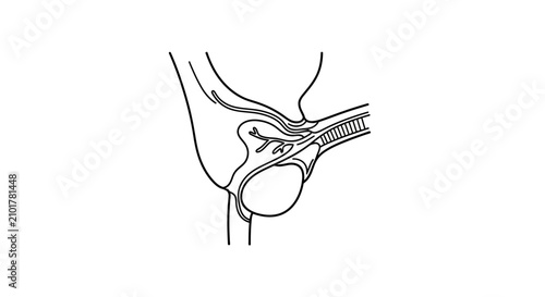 Anatomical illustration of the male reproductive system, showing seminal vesicles and vas deferens.
