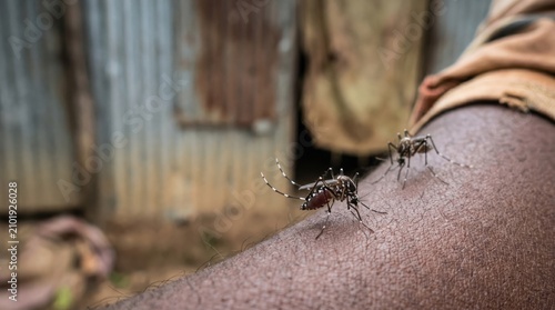 Mosquitoes biting dark skin in a rural slum with corrugated iron background, highlighting global health crises like malaria, zika, and dengue fever in poverty-stricken tropical regions.