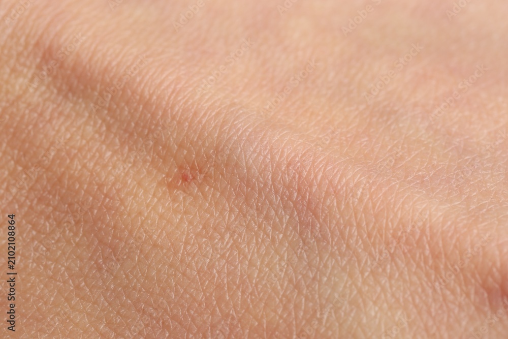 Fototapeta premium Texture of normal skin as background, closeup